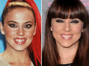 Dentist in Mexico Shows Smile Makeovers On Hollywood Celebrities