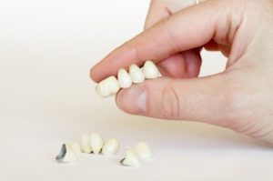 4 FAQ About Porcelain Dental Crowns & Prices