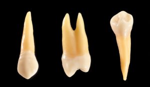 A link between periodontitis and Alzheimer’s?