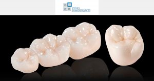 What are the differences of porcelain crowns and zirconia crowns?