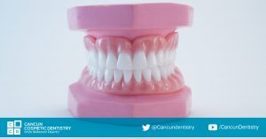 Snap in Dentures is your dental solution! Cancun Cosmetic Dentistry
