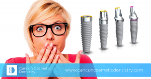 Can I be allergic to dental implants? – Cancun Cosmetic Dentistry