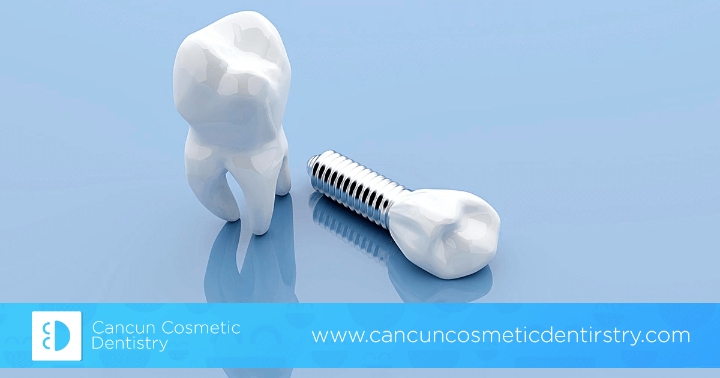 Are there any complications with dental implants – Cancun Cosmetic Dentistry