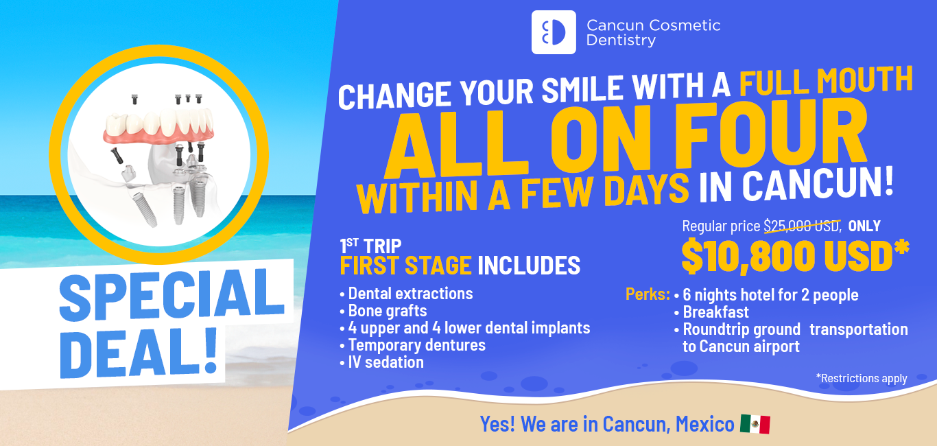 Cancun Cosmetic Dentistry