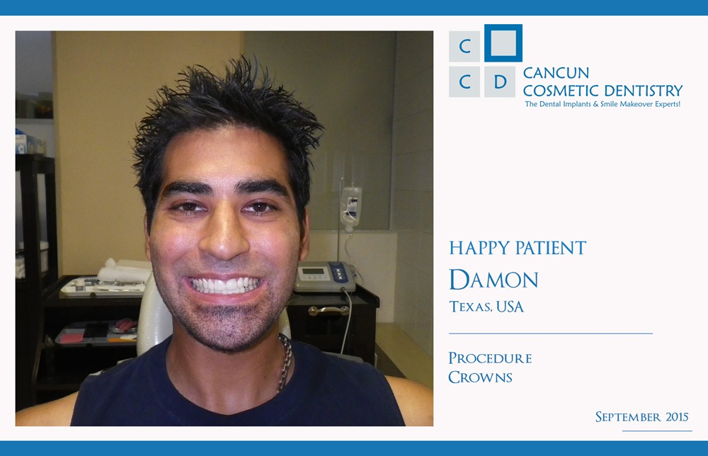Happy Patient with affordable dentists in Cancun