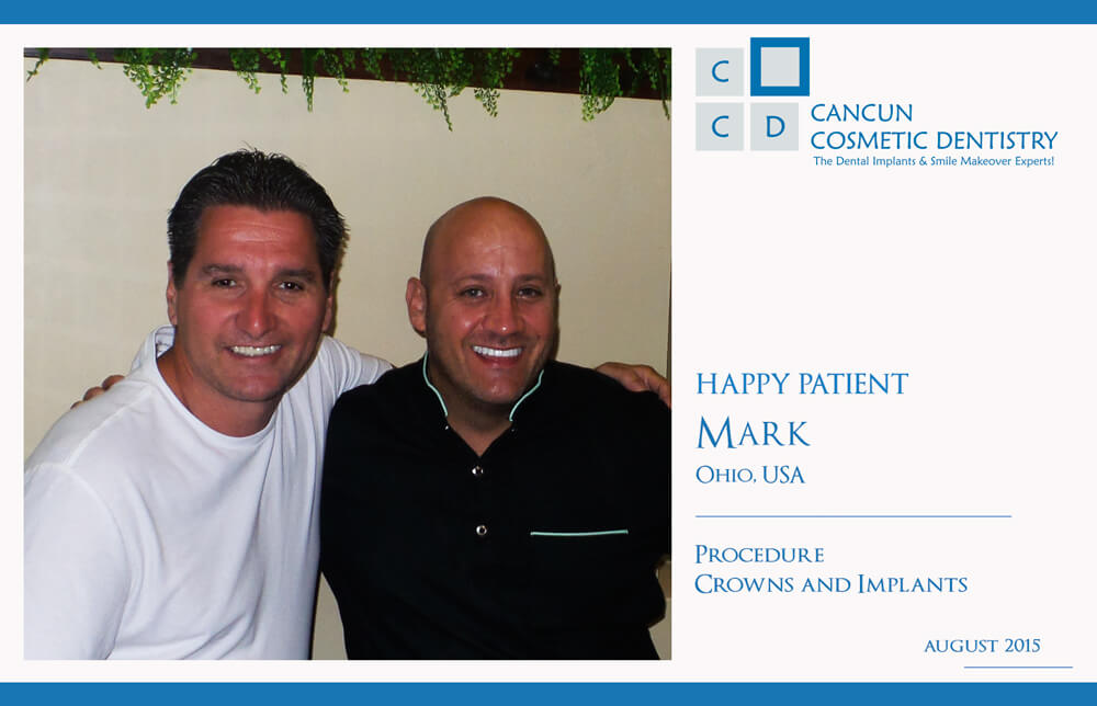 Cancun cosmetic dentistry patient Review
