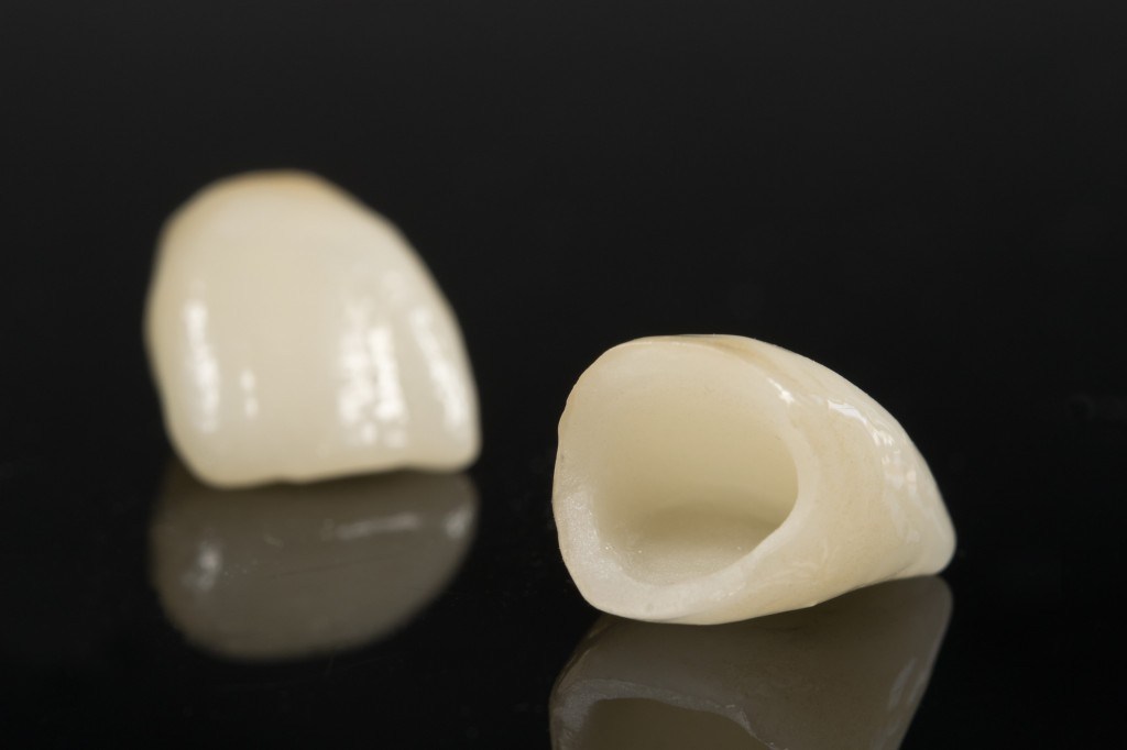 Porcelain Crown in Cancun teeth tooth