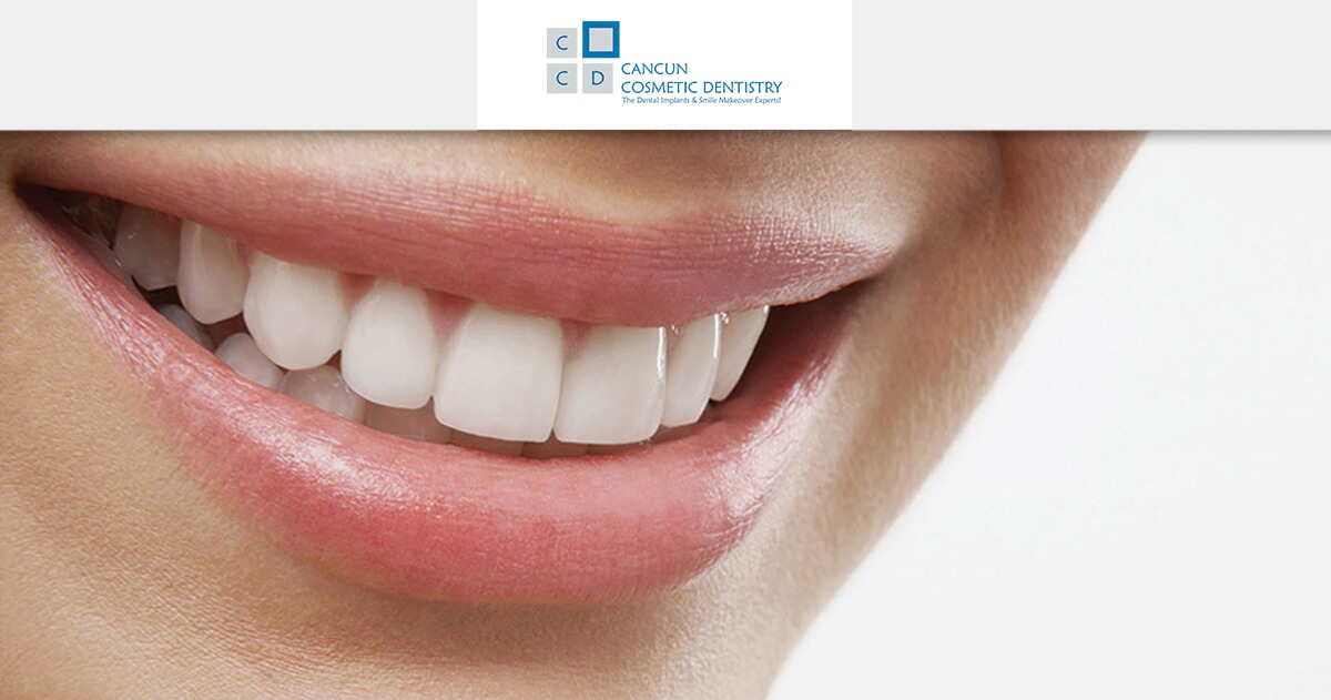What is a dental restoration? - Cancun Cosmetic Dentistry