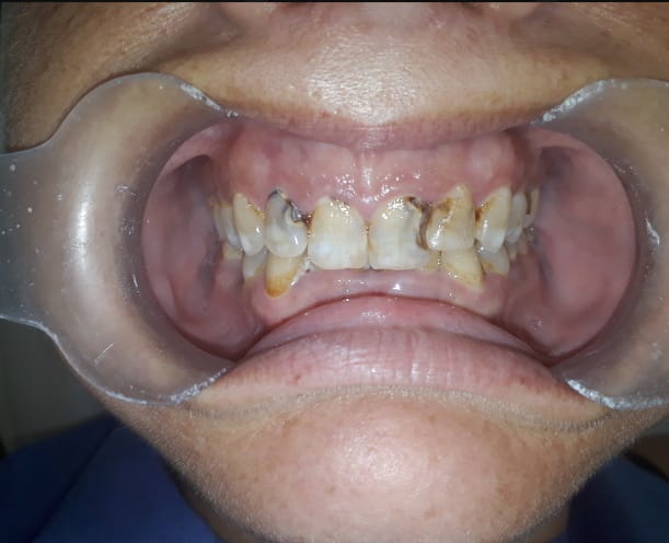 Cancun Cosmetic Dentistry