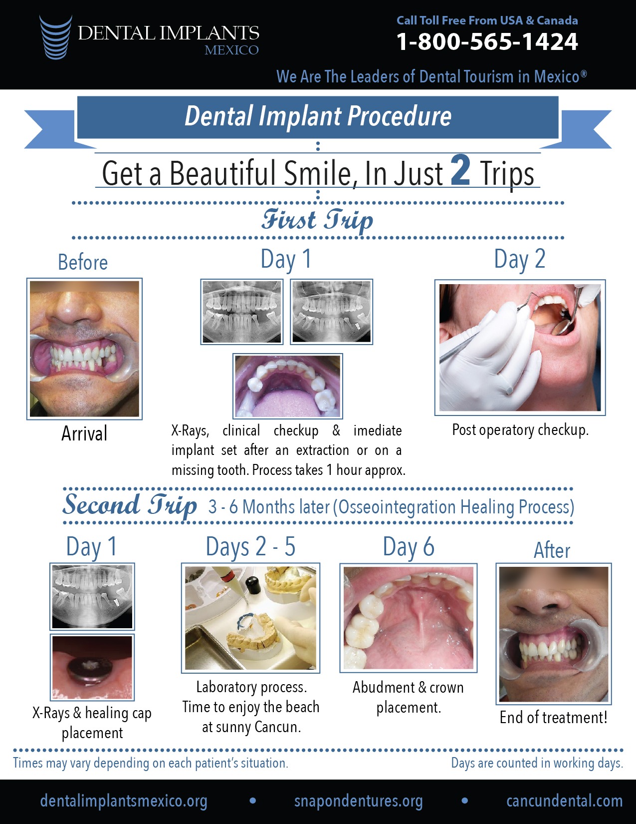 stepbystepmanualdentalimplants Cancun Cosmetic Dentistry