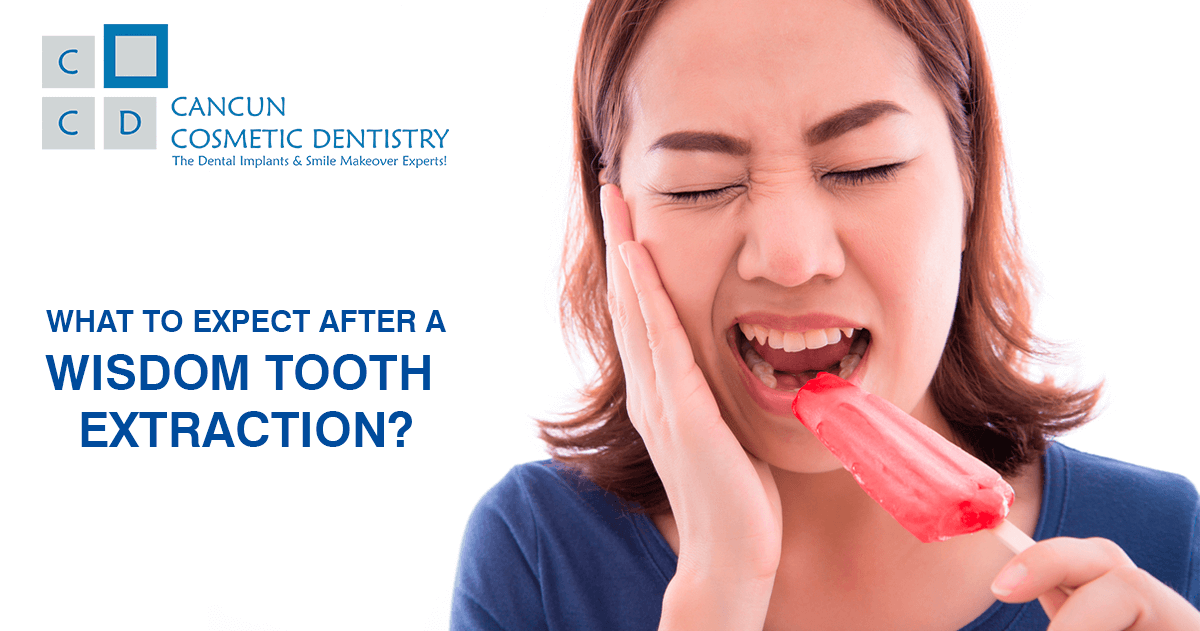 Wisdom Tooth Extraction Surgery in Cancun